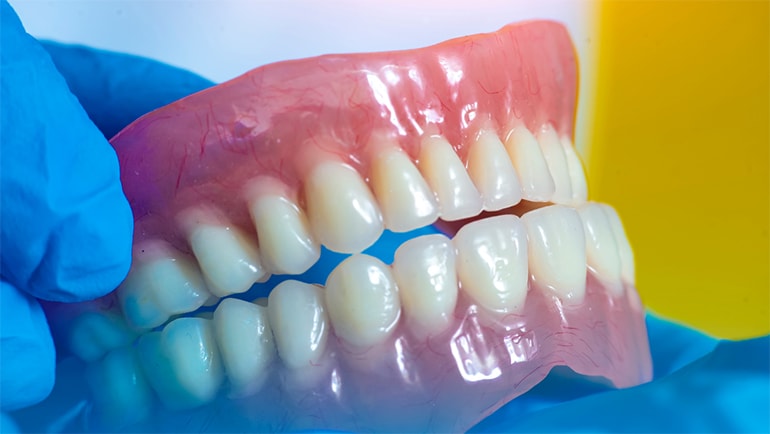Herausnehmbarer Zahnersatz